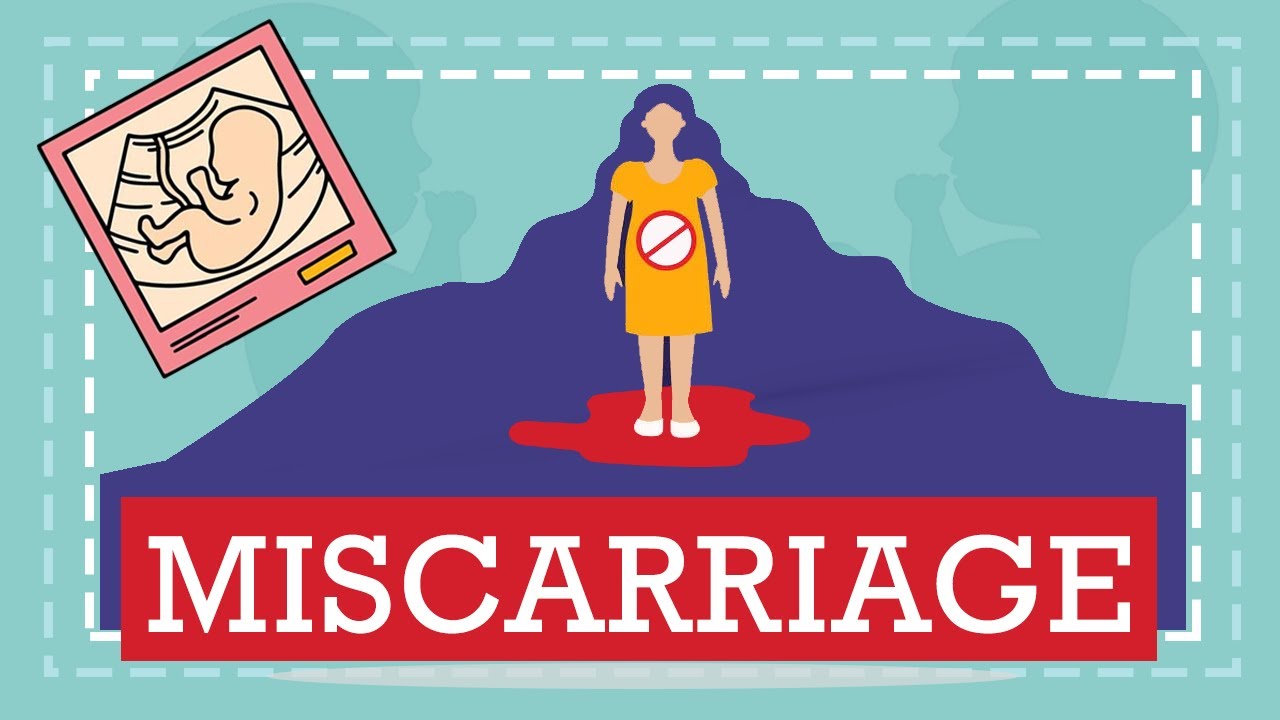 8 best ways to get rid of Miscarriage Causes