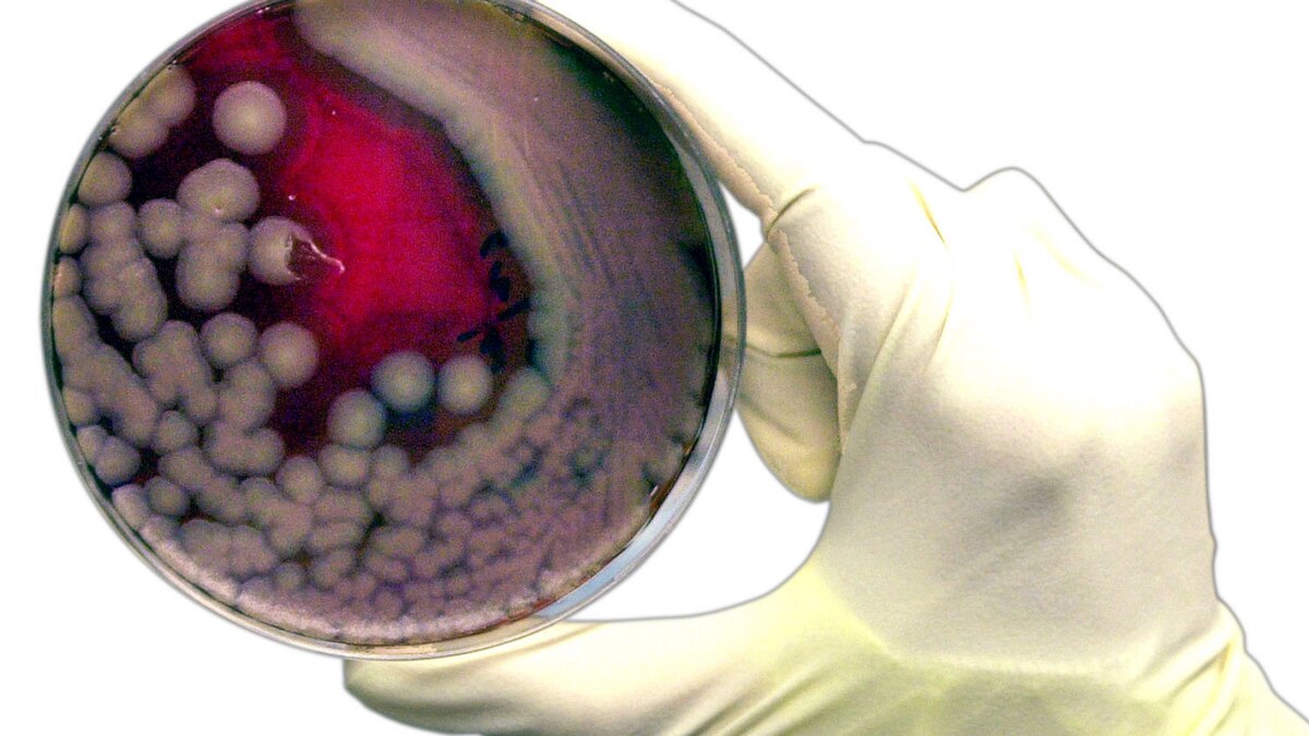 Ways to Prevent Food Poisoning
